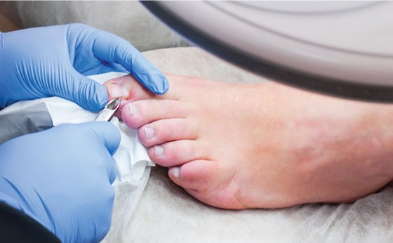 toenail cutting cardiff